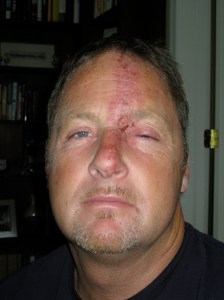 It actually hurt much worse than it looks.